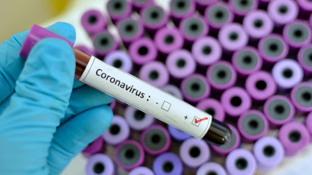 “Paperoni del vaccino”: crescono in borsa gli investitori dei farmaci anti-Covid